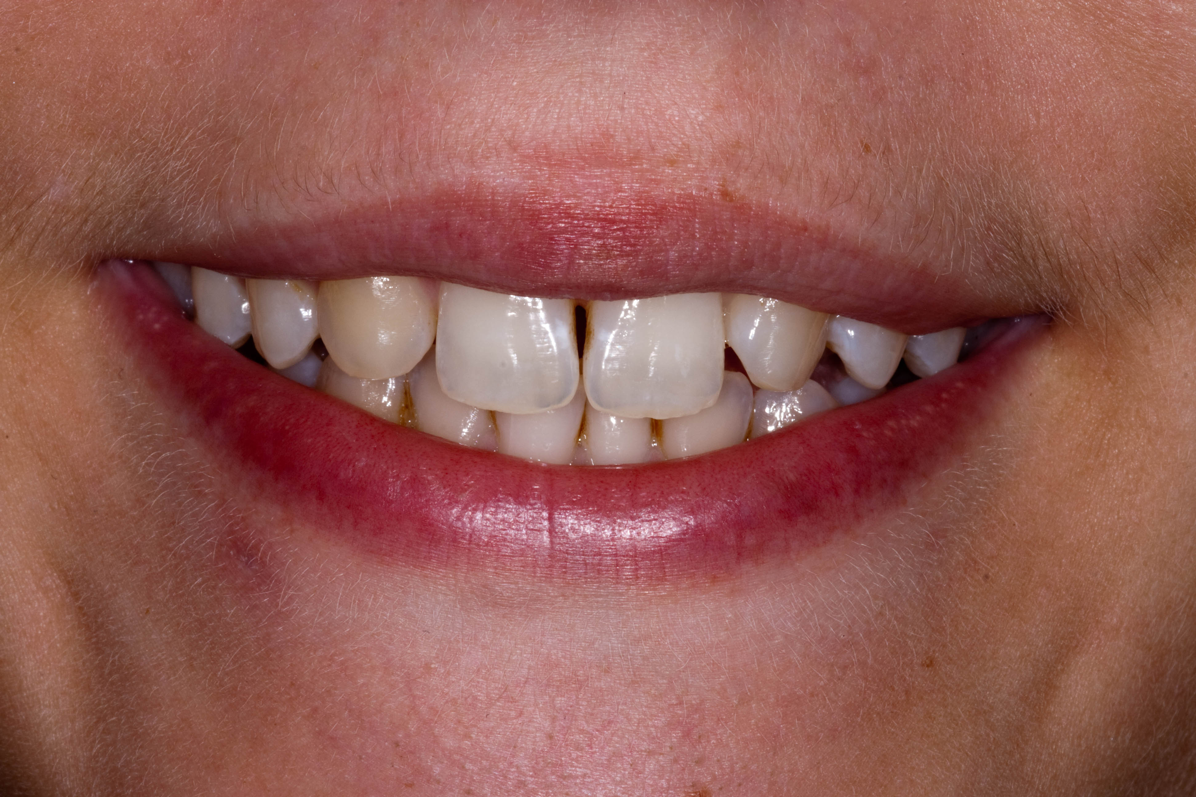 harrow teeth dentist confidence lack court dentistry dental